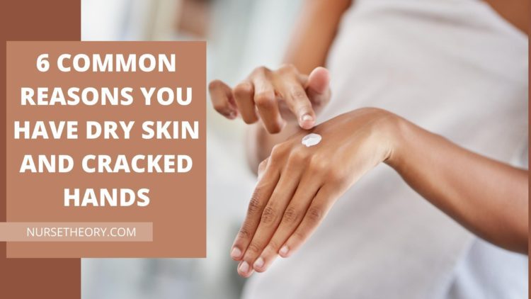 Dry Skin and Cracked Hands